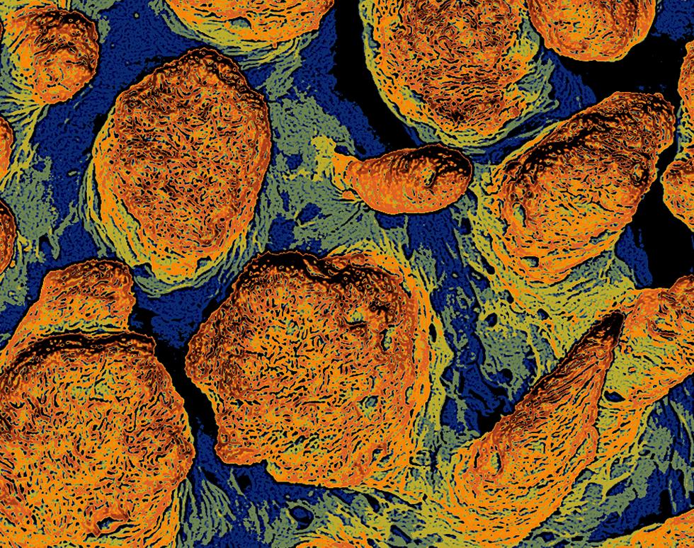 Skin Deep - Sandie Dixon